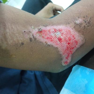 Cuci Luka Kemalangan 1
