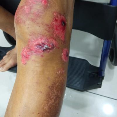 Cuci Luka Kemalangan 3
